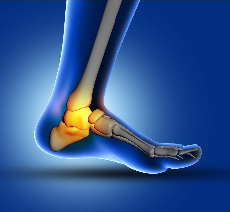 Ankle Surgery