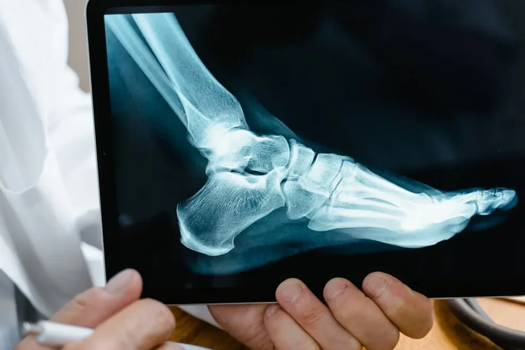 Foot Surgery